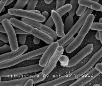 Infecția cu Escherichia Coli (STEC/VTEC) producătoare  de toxine SHIGA/VERO (STEC/VTEC)